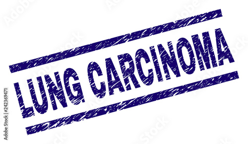 LUNG CARCINOMA seal print with distress style. Blue vector rubber print of LUNG CARCINOMA title with dirty texture. Text title is placed between parallel lines.