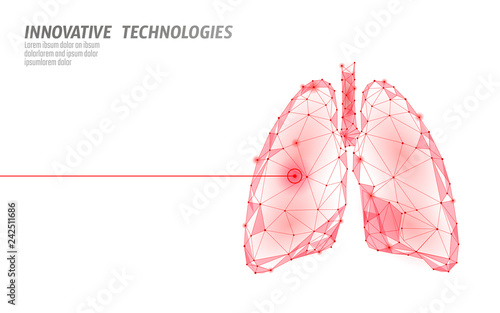 Human lungs laser surgery operation low poly. Medicine disease drug treatment painful area. Red triangles polygonal 3D render shape. Pharmacy tuberculosis cancer template vector illustration