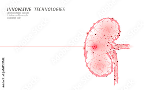 Human kidneys laser surgery operation low poly. Medicine disease drug treatment painful area. Red triangles polygonal 3D render shape. Pharmacy stones cancer recovery template vector illustration