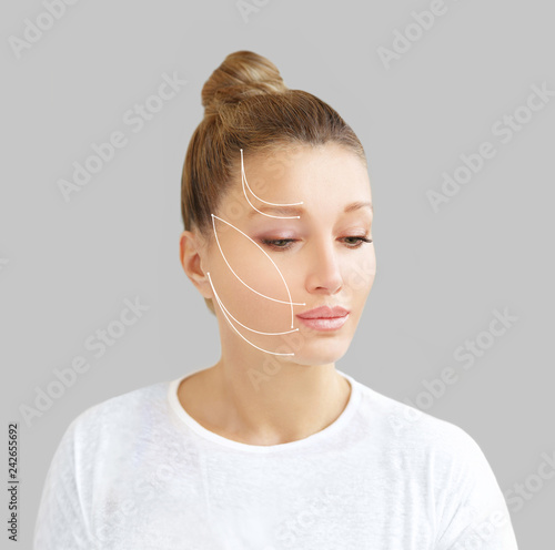 Fotografie Thread Lift ,markup