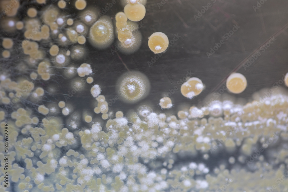 Colony characteristic of Actinomyces, Bacteria, yeast and Mold on ...