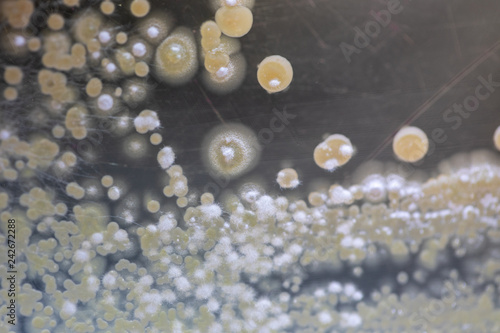 Colony characteristic of Actinomyces, Bacteria, yeast and Mold on selective media from soil samples for study in laboratory microbiology.