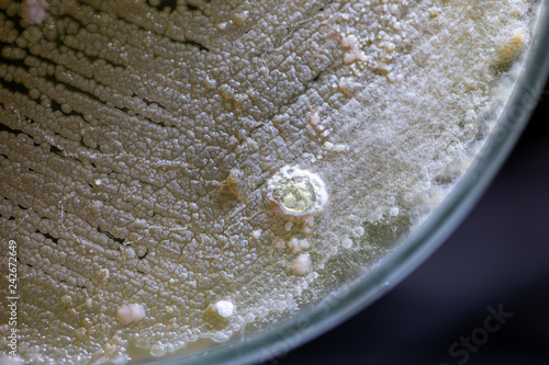 Colony characteristic of Actinomyces, Bacteria, yeast and Mold on selective media from soil samples for study in laboratory microbiology.