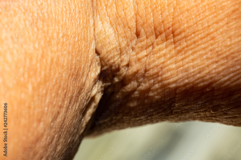 Senior woman's wrinkled foldable joint of the arm, Close up & Macro shot, Selective focus, Light & Shadow, Body part, Healthcare concept Senior woman's wrinkled foldable joint of the arm, Close up & Macro shot, Selective focus, Light & Shadow, Body part, Healthcare concept