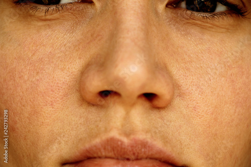 wrinkles and pores on the face