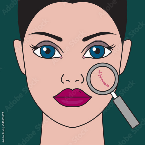 Removal of scars from face