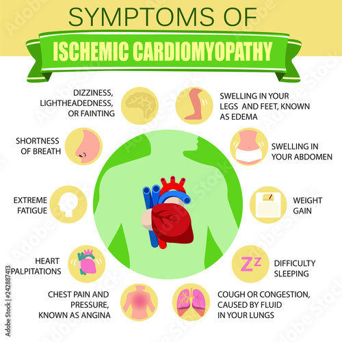 Symptoms of ischemic cardiomyopathy. Detailed vector Infographic.
