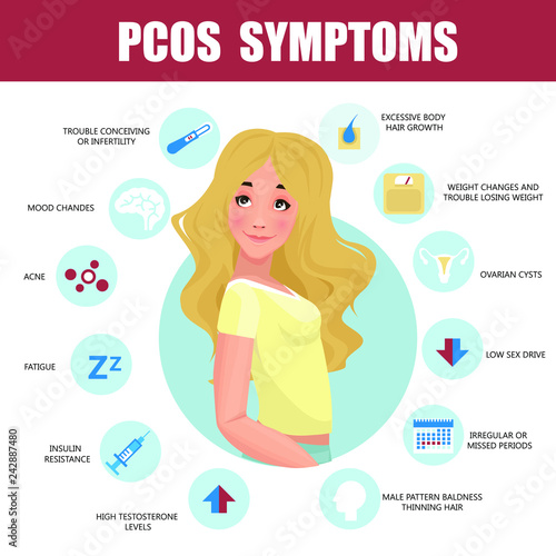 PCOS Symptoms infographic. Detailed vector Infographic. Women Health