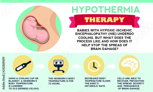 Therapeutic hypothermia. Treatment for hypoxic ischemic encephalopathy (HIE). Detailed vector Infographic. Baby Health