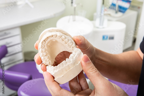 Gypsum model of jaw with teeth in in the hands of a dentist photo