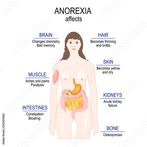 low weight. Anorexia affects. healthy lifestyle