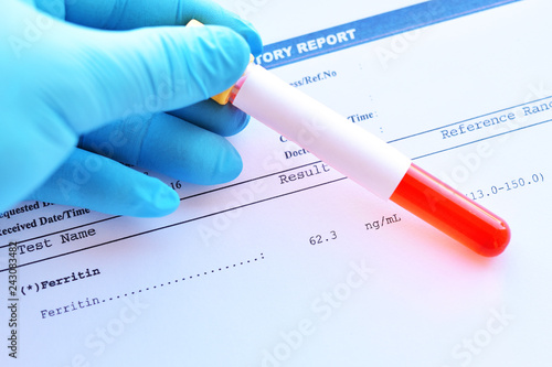Laboratory result of ferritin test with blood sample
 photo
