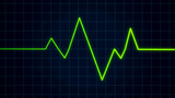 Heartbeat pulse on cardiogram screen, EKG ECG cardio healthcare concept