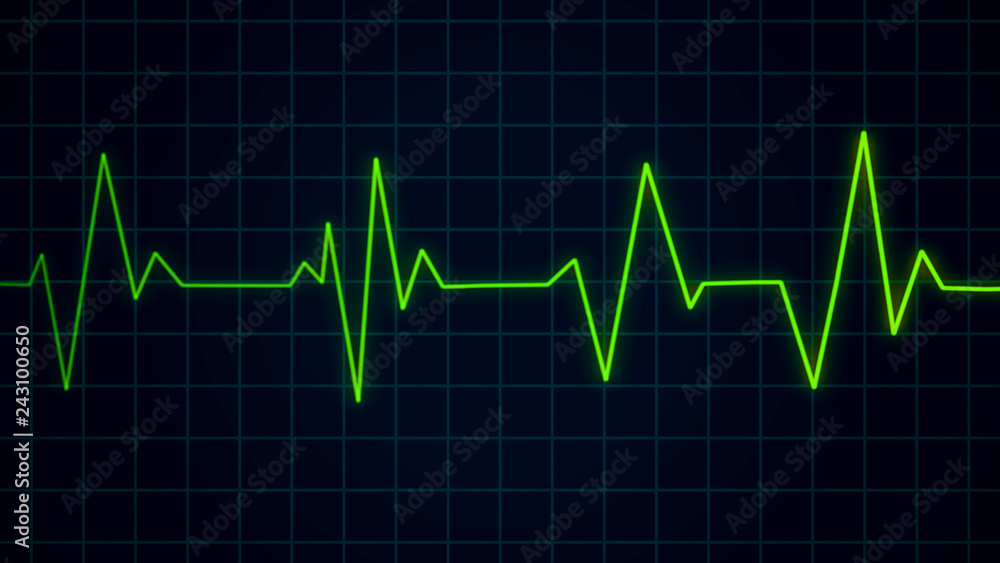 Heartbeat pulse on cardiogram screen, EKG ECG cardio healthcare concept Heartbeat pulse on cardiogram screen, EKG ECG cardio healthcare concept