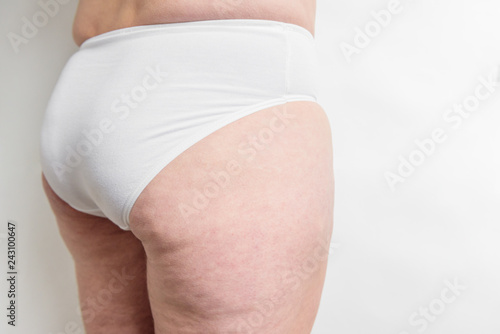 Fat female body with cellulite, overweight hips and legs on white background. Woman with cellulite problem.