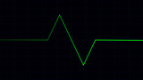 Heartbeat pulse on cardiogram screen, EKG ECG cardio healthcare concept