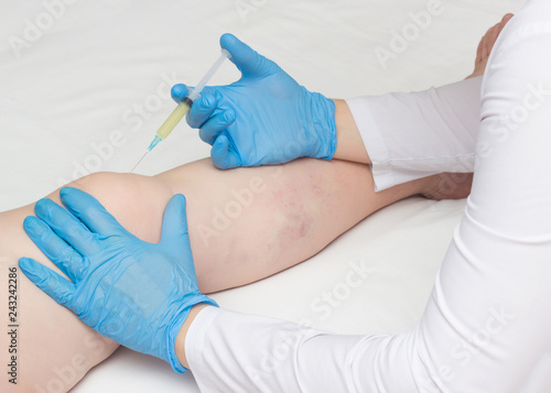 The doctor injects plasma into the knee joint of a woman to eliminate pain and symptoms of arthritis and arthrosis, relieve inflammation with a plasma-lifting method photo