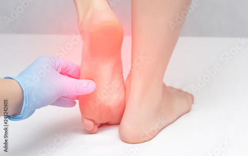 The doctor examines the patient s feet for mycosis and corns, cracked heels, medical, dermatology, pain