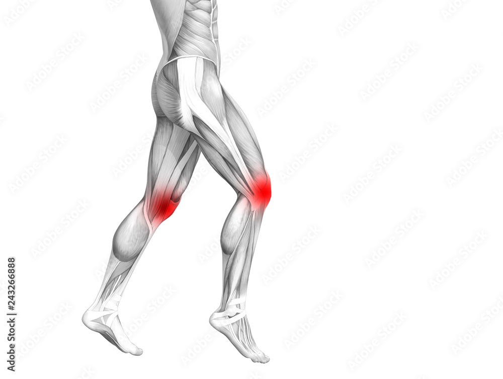 Conceptual knee human anatomy with red hot spot inflammation or articular joint pain for leg health care therapy or sport muscle concepts. 3D illustration man arthritis or bone osteoporosis disease Conceptual knee human anatomy with red hot spot inflammation or articular joint pain for leg health care therapy or sport muscle concepts. 3D illustration man arthritis or bone osteoporosis disease