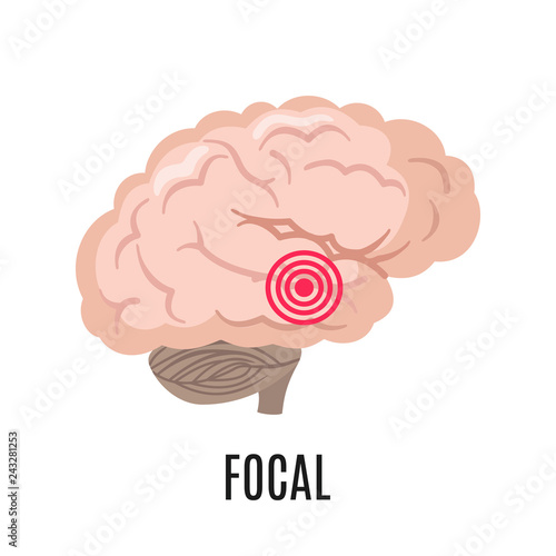 Focal epilepsy icon isolated on white background.