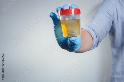 Hand in a blue glove holding medical urine test on gray background