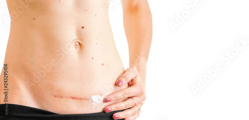 Photo woman belly with scar c Cesarean healing cream medicine isolated white backgroun