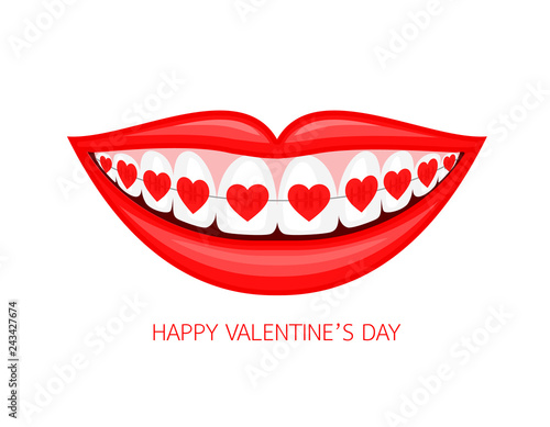 Human mouth with heart braces. Vector illustration isolated on white background. Dental care concept.