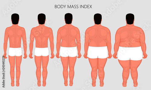 Vector illustration Human body mass Index, European man from lack of weight to obesity back view. For advertising of cosmetic plastic procedures, stomach shunting, diet, medical publications