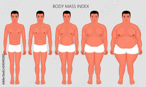 Vector illustration Human body mass Index, European man from lack of weight to obesity Front view. For advertising of cosmetic plastic procedures, stomach shunting, diet, medical publications