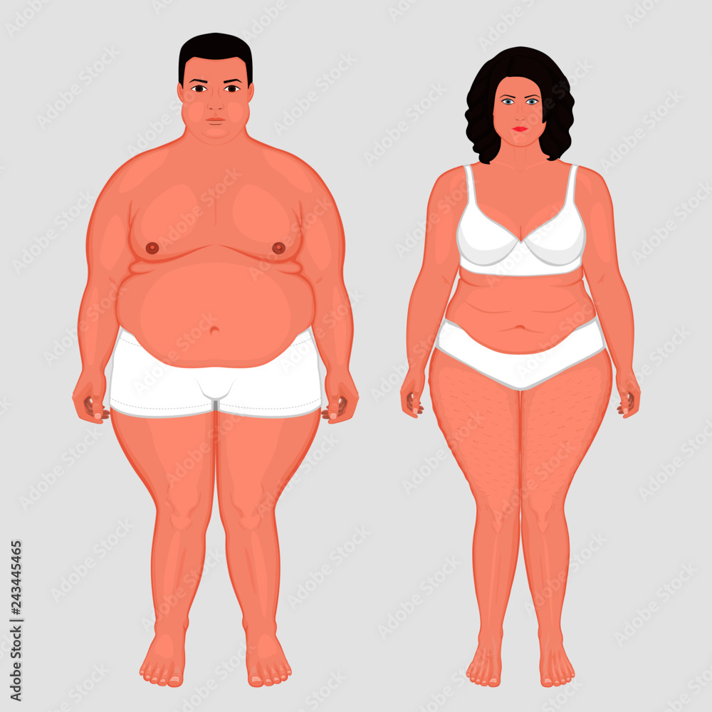 Vector illustration of a European couple - man and woman with obesity or overweight. Front view. For advertising of cosmetic plastic procedures, stomach shunting, diet; medical publications Vector illustration of a European couple - man and woman with obesity or overweight. Front view. For advertising of cosmetic plastic procedures, stomach shunting, diet; medical publications