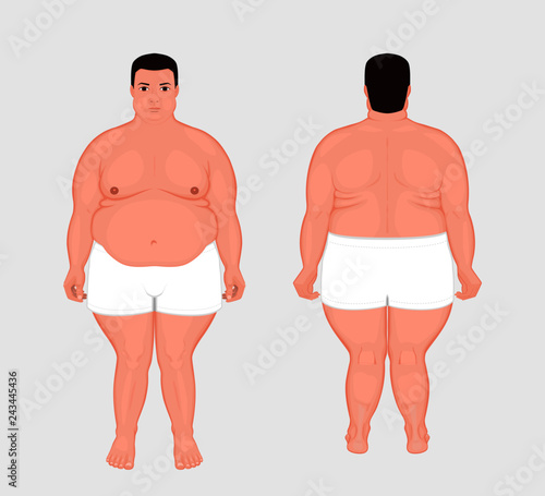 Vector illustration. Front, back views of naked European man in full growth in underwear. For advertising of cosmetic plastic procedures, stomach shunting, bypass, diet, medical publications © Aksana