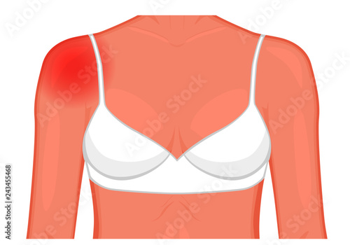 Vector illustration of a human shoulder joint with a pain or injury. Front view. For advertising, medical publications