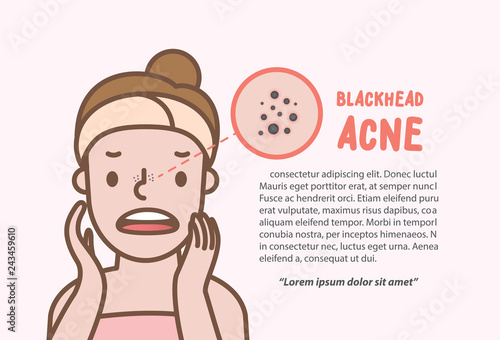 Blackhead acne woman cartoon action half body layout banner illustration vector on pink background. Beauty concept.