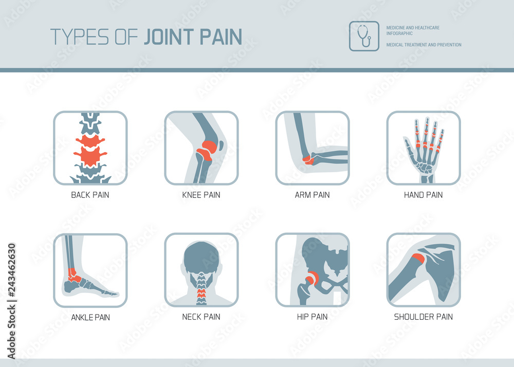 Types of joint pain - obrazy, fototapety, plakaty 