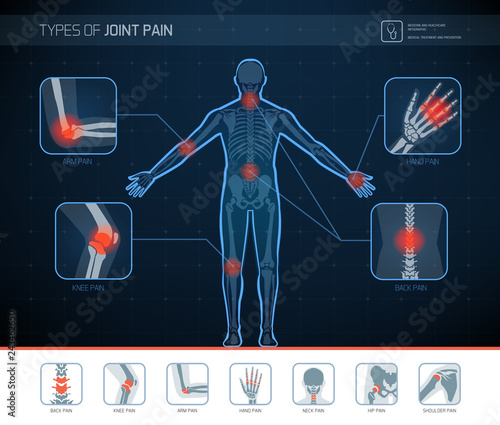 Types of joint pain infographic