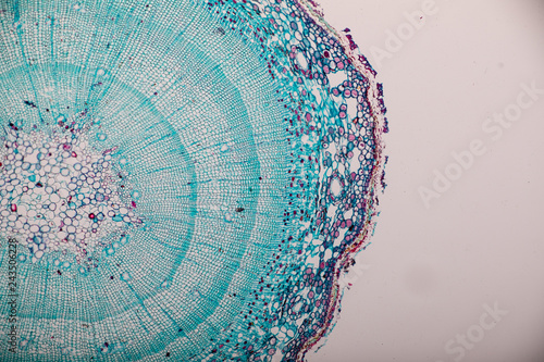 Cross-section Dicot, Monocot and Root of Plant Stem under the microscope for classroom education.  photo