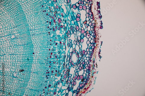 Fotografie Cross-section Dicot, Monocot and Root of Plant Stem under the microscope for classroom education