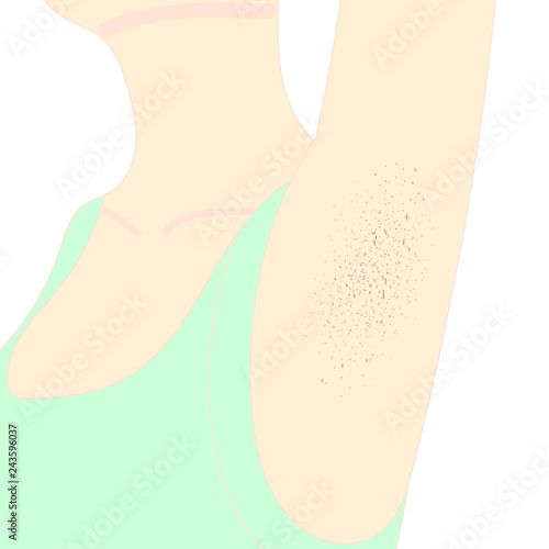 Black armpits and dark spots. Pores, skin problems.- Vector 