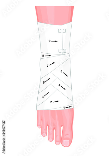 Correct way to wrap an ankle by flexible elastic supportive orthopedic bandage (sprain, strain).