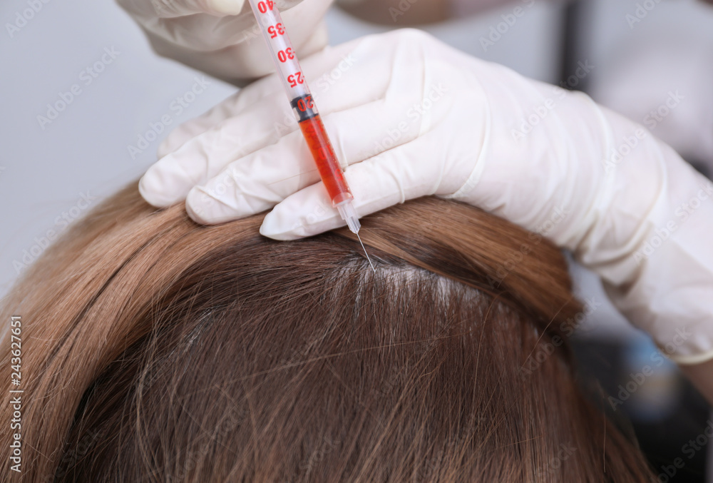 Woman with hair loss problem receiving injection in clinic, closeup Woman with hair loss problem receiving injection in clinic, closeup