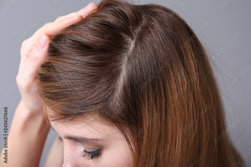 Woman with hair loss problem on grey background, closeup Woman with hair loss problem on grey background, closeup