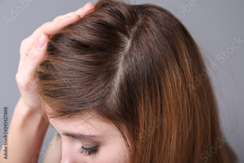 Woman with hair loss problem on grey background, closeup