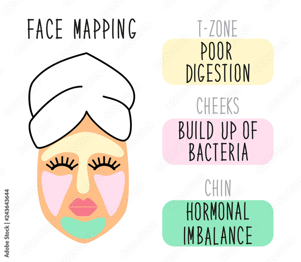 Vetor de Cute infographic of face mapping, reasons of acne