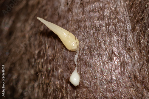 Dipylidium caninum gravid proglottid in the cat's perianal region.