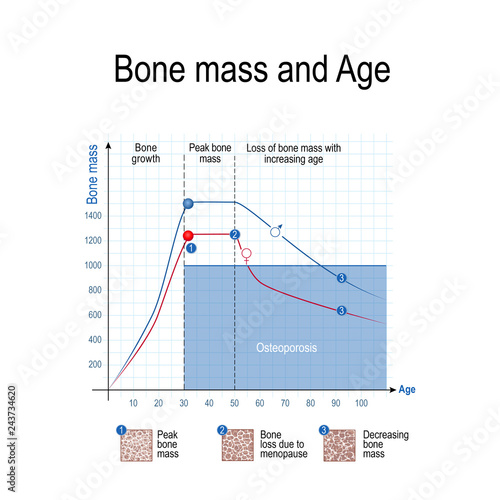 Bone mass for male and female. Age and osteoporosis. Chart.