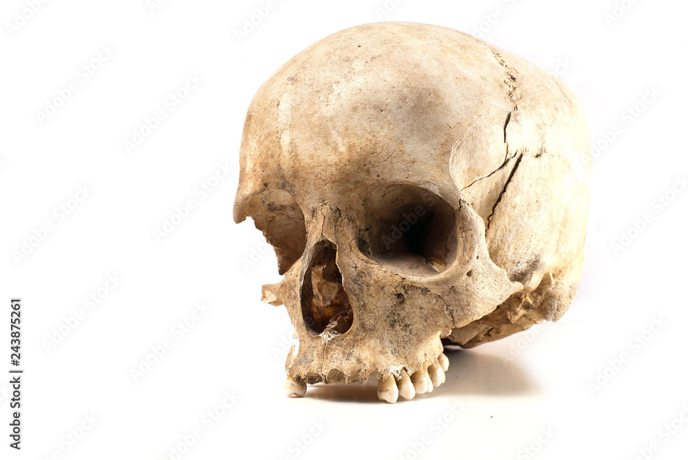 Obraz premium An old, cracked real human skull