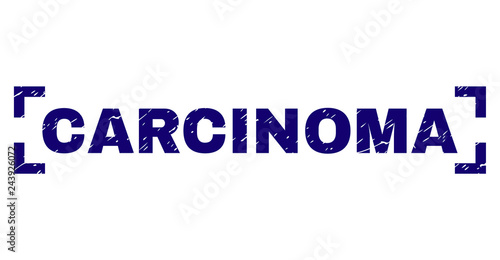 CARCINOMA text seal print with grunge texture. Text caption is placed between corners. Blue vector rubber print of CARCINOMA with unclean texture.