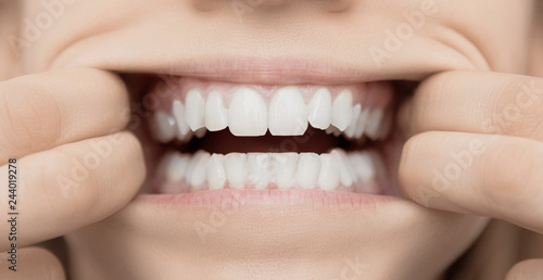 Woman's teeth