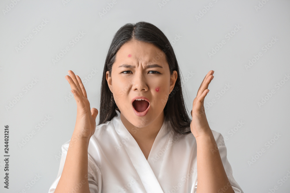 Portrait of stressed Asian woman with acne problem on white background Portrait of stressed Asian woman with acne problem on white background