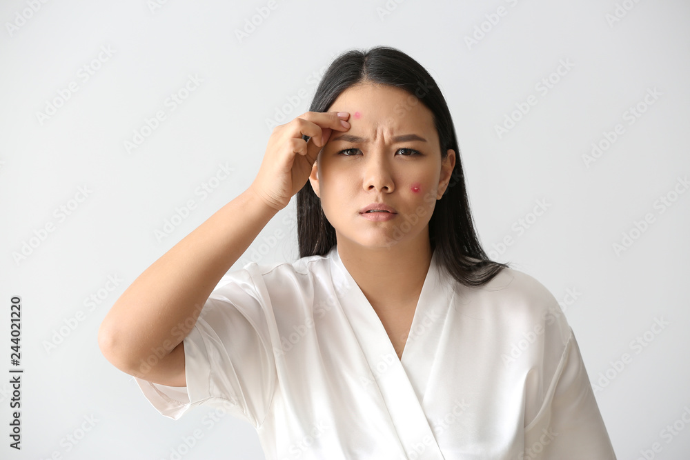 Portrait of young Asian woman with acne problem on white background Portrait of young Asian woman with acne problem on white background